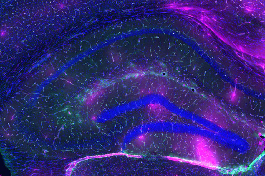 El marcado deterioro estructural de una barrera envejecida que ha perdido su estanqueidad celular, abriendo las puertas al declive cognitivo. (Crédito: Laboratorio Villeda, UCSF)