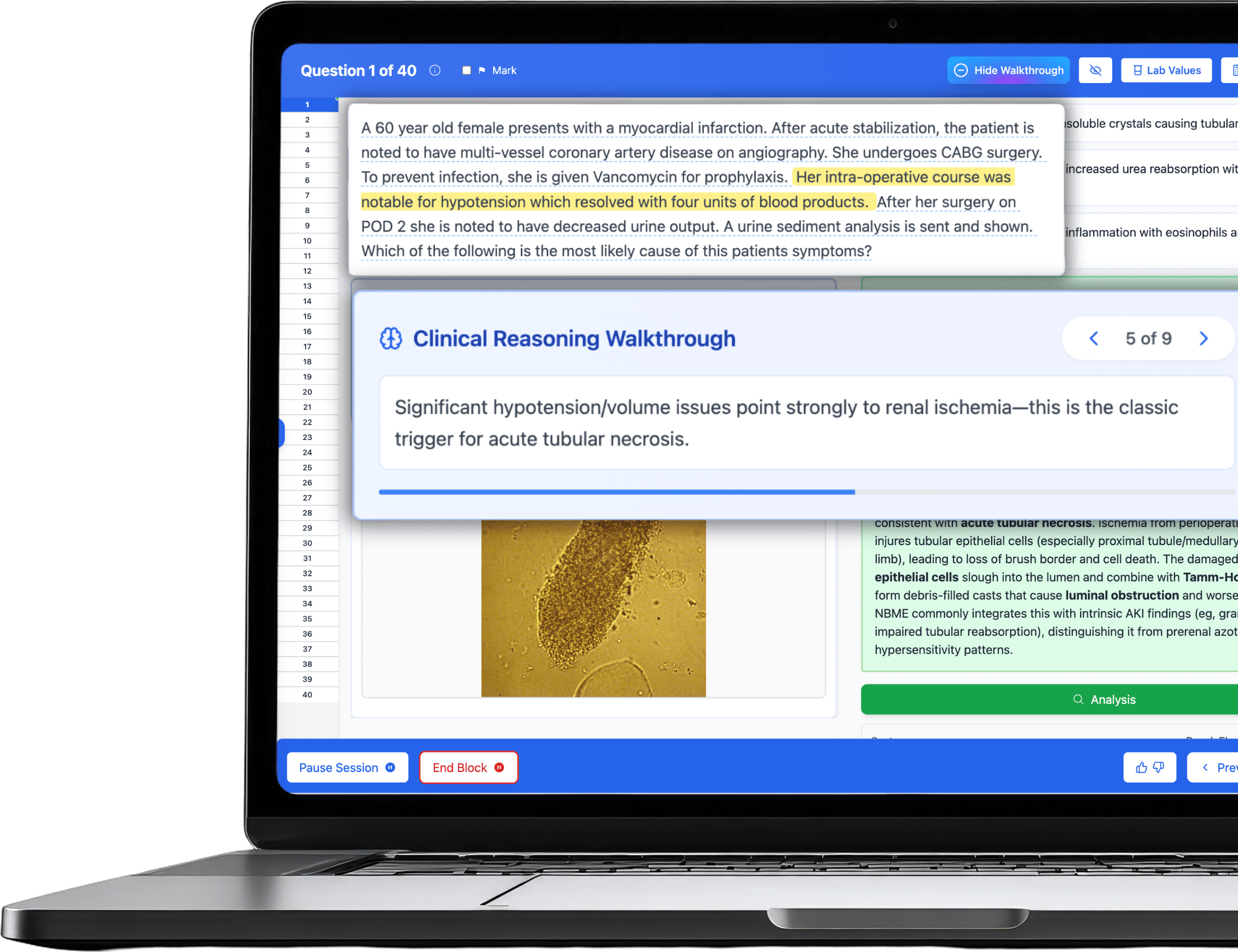 Guru Qbank on a laptop showing a clinical vignette with the Clinical Reasoning Walkthrough panel open