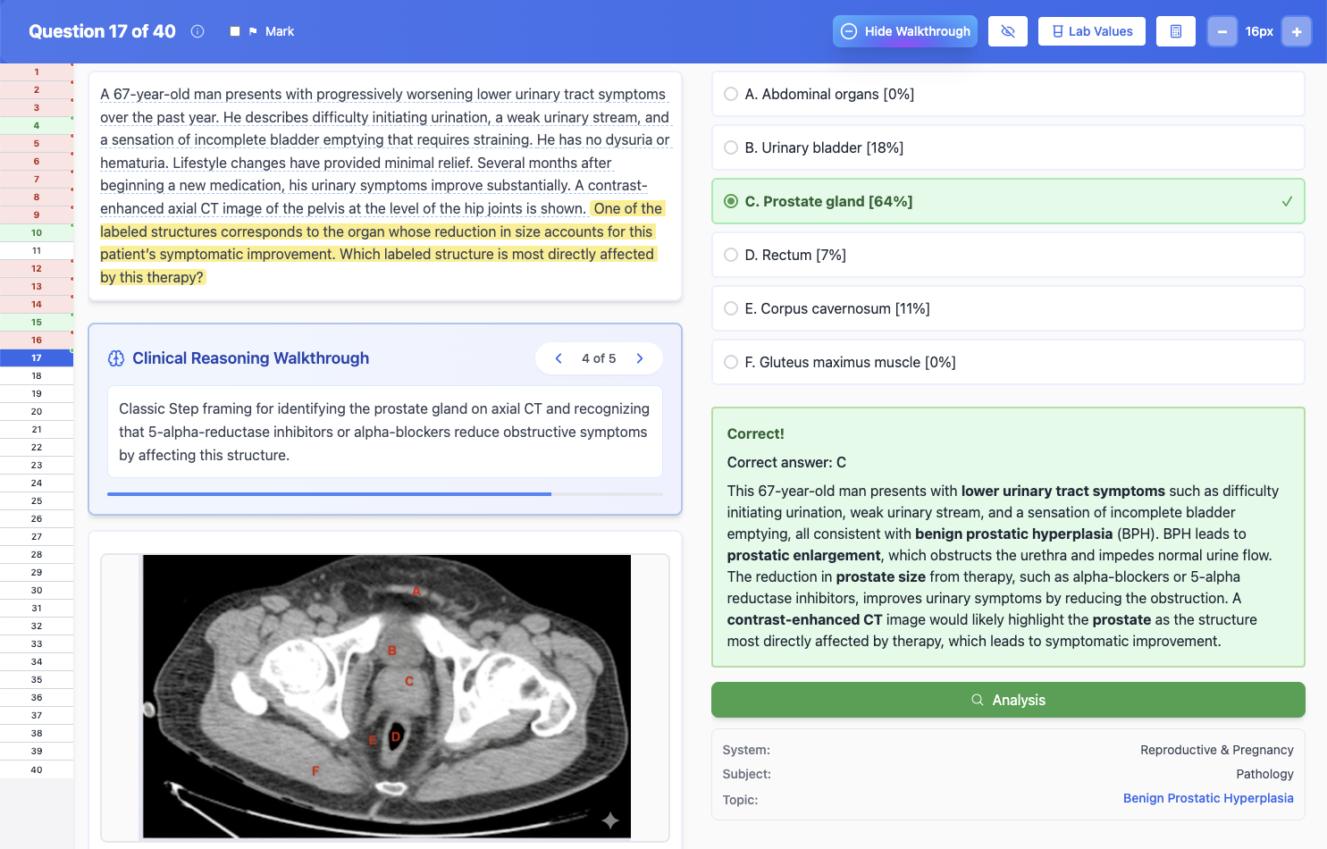 Guru QBank question with the Clinical Reasoning Walkthrough panel open