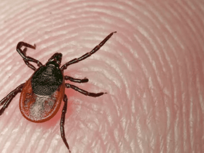 Эксперты назвали самый эффективный способ защиты от клещей: вы будете удивлены его простоте
