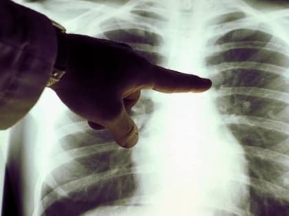 Российские ученые приступают к испытаниям вакцины от рака