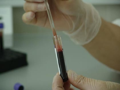 Жители Шарыпово смогут пройти экспресс-тестирование на ВИЧ