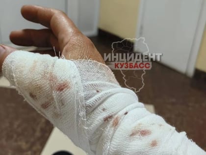 Нападение стаи хаски на женщину в парке «ХаскиЛэнд»