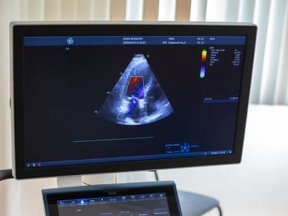 УЗИ-оборудование экспертного класса дополнило арсенал Красноярской межрайонной больницы скорой медицинской помощи им. Н.С. Карповича