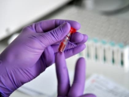 Роспотребнадзор начнет проверки из-за случаев вируса Коксаки