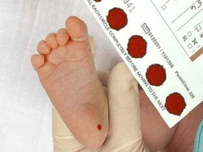 100 процентов новорождённых в Богучанском районе охвачены  неонатальным скринингом