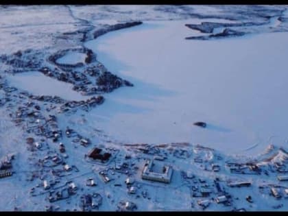 В посёлке Красноярского края около 40 человек подхватили инфекцию: от нее появляется сыпь