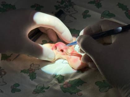 ​Пострадавший от укуса собаки мальчик из КЧР продолжает лечение в больнице Черкесска