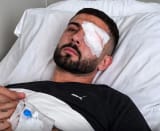 Lajm i mirë për Erjon Vishkullin, 28-vjeçari operohet me sukses në Romë...