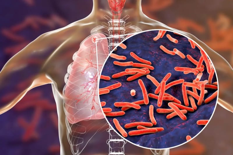 “Murtaja e Bardhë” po rritet në SHBA, më vdekjeprurëse se COVID‑19 dhe rezistente ndaj antibiotikëve...