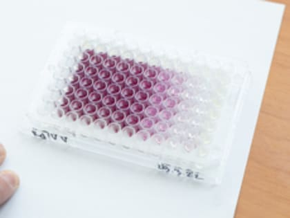 Научное открытие в Екатеринбурге: новое вещество против глиобластомы