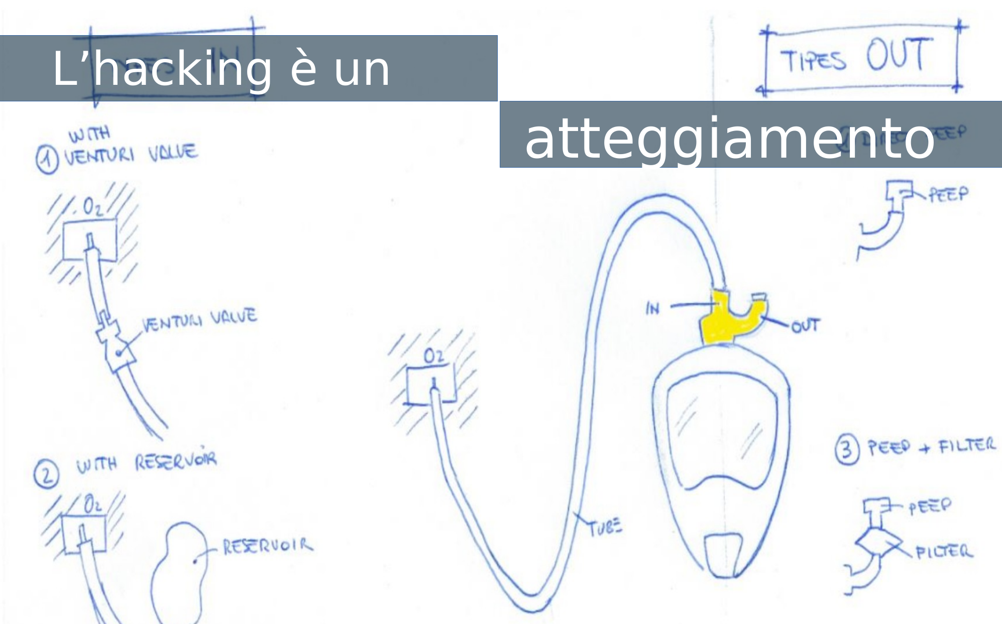 Hacking è un atteggiamento - una maschera da sub trasformata in ventilazione assistita