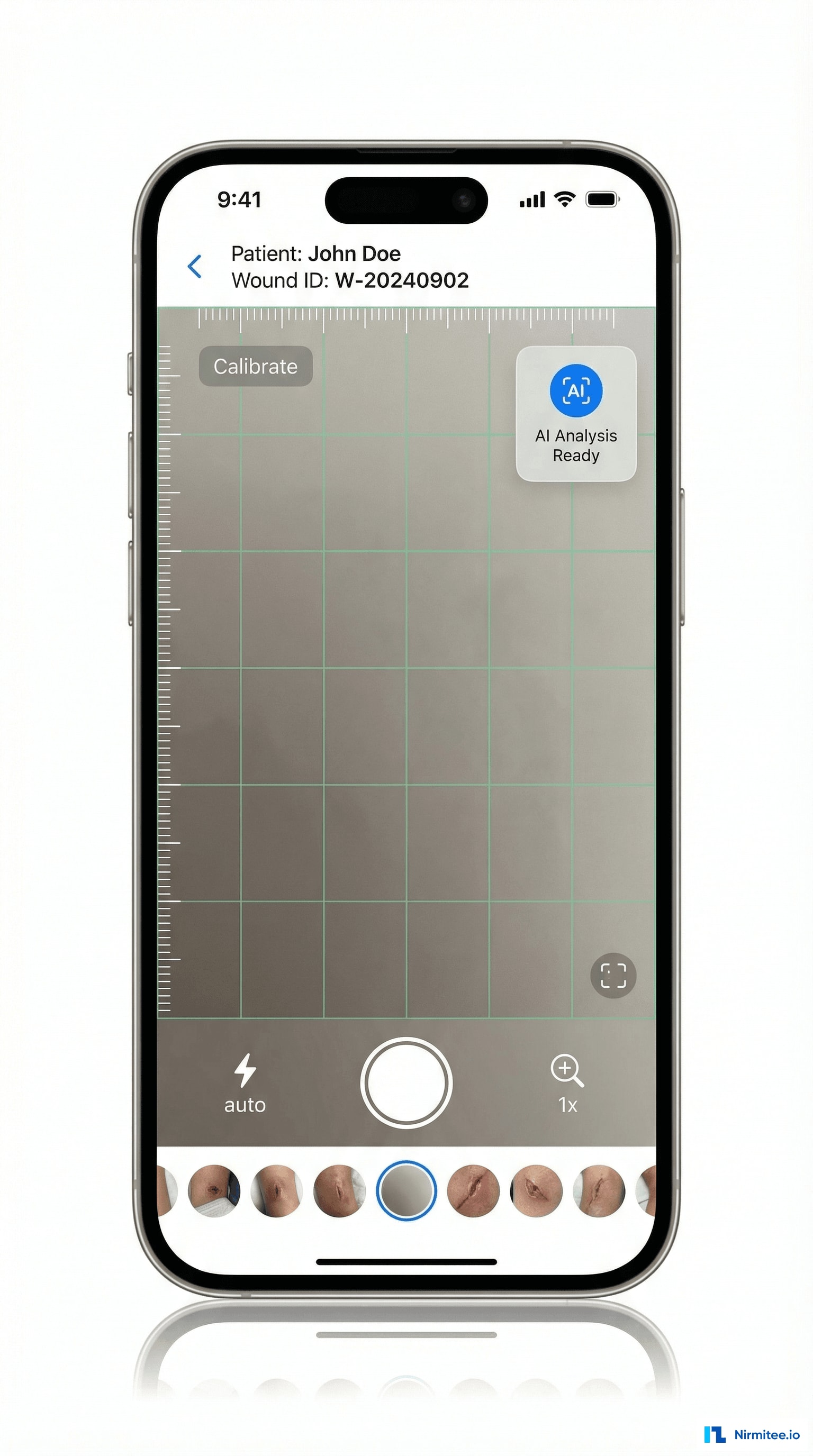 Wound Photo Capture Mobile App with AI Measurement Overlay