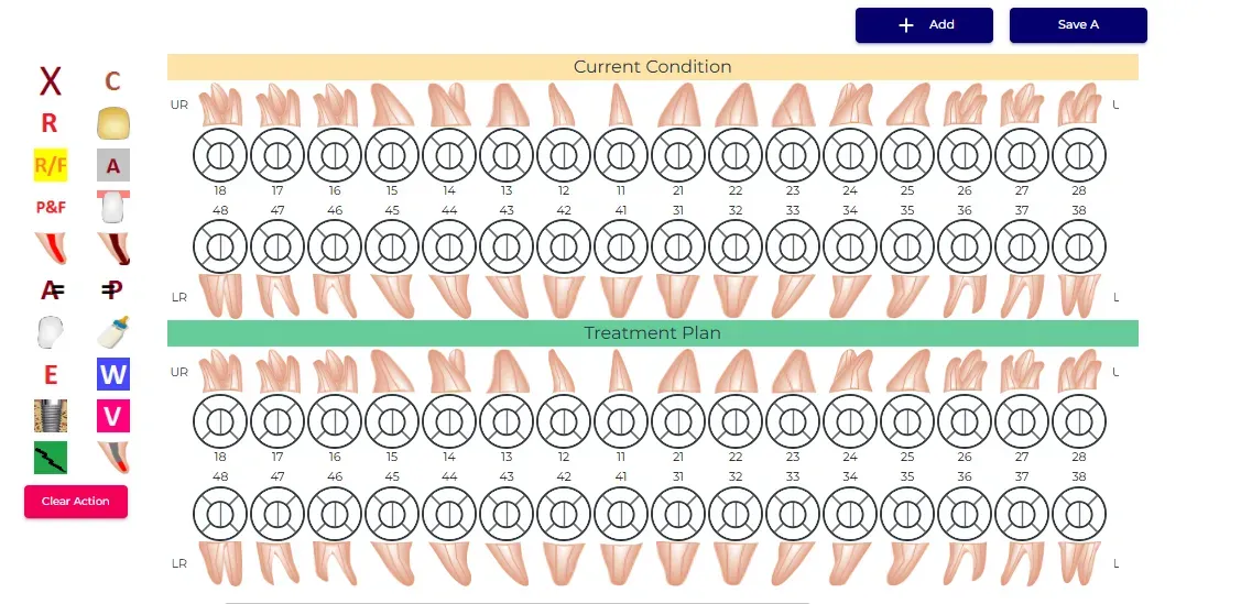 Dental Chart 