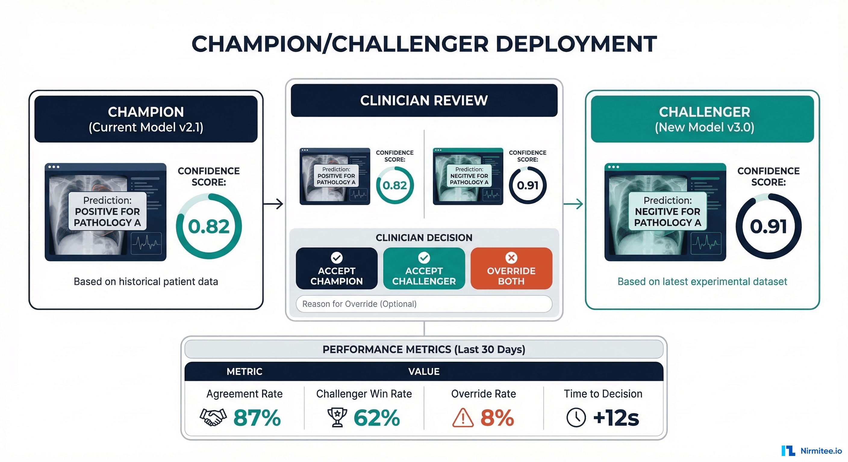 Champion/challenger deployment showing two model outputs presented to clinician who chooses which to accept with agreement and win rate metrics