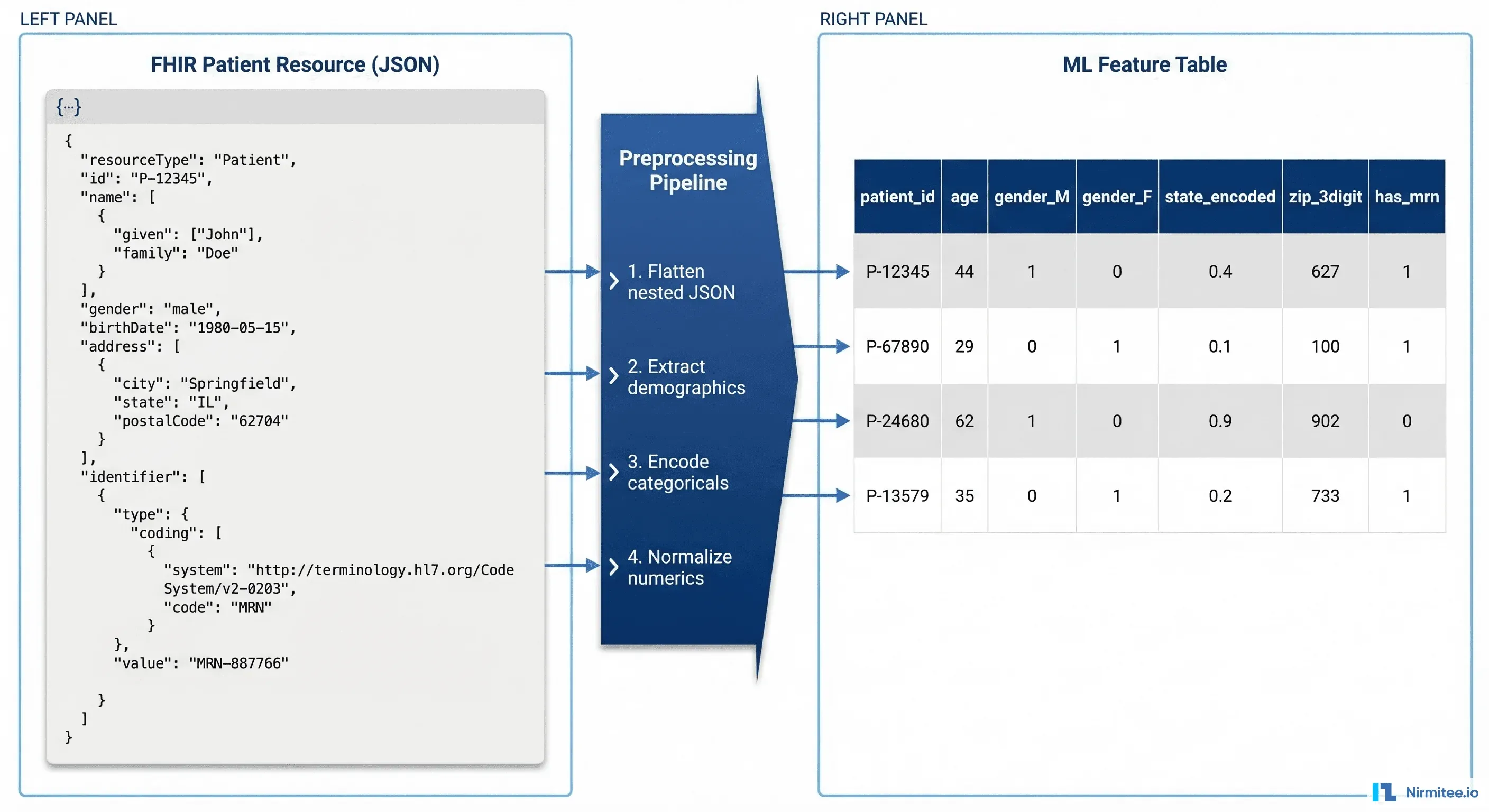 FHIR Patient JSON resource being transformed through preprocessing steps into a flat ML feature table