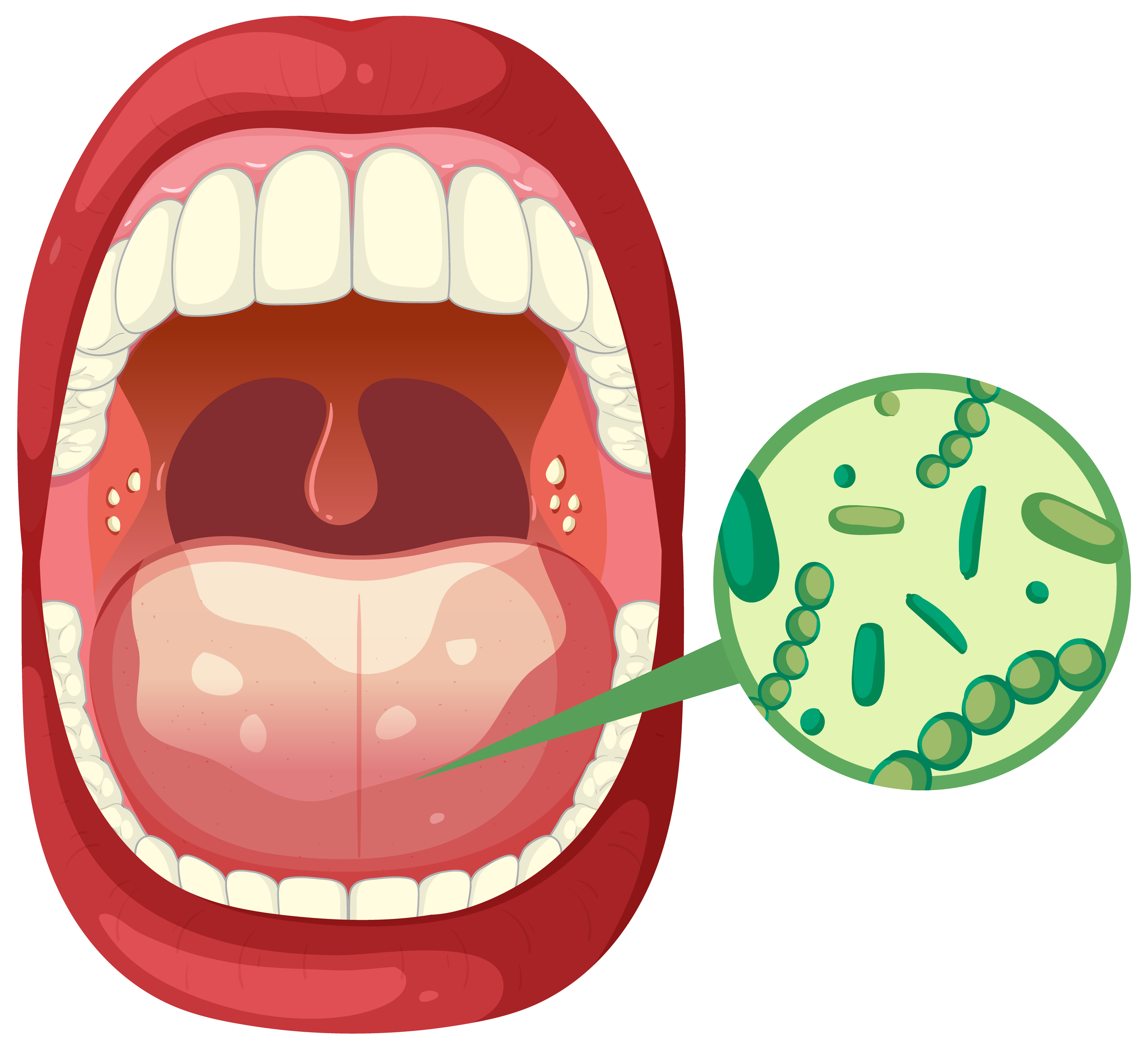 Mengenal oral mukositis