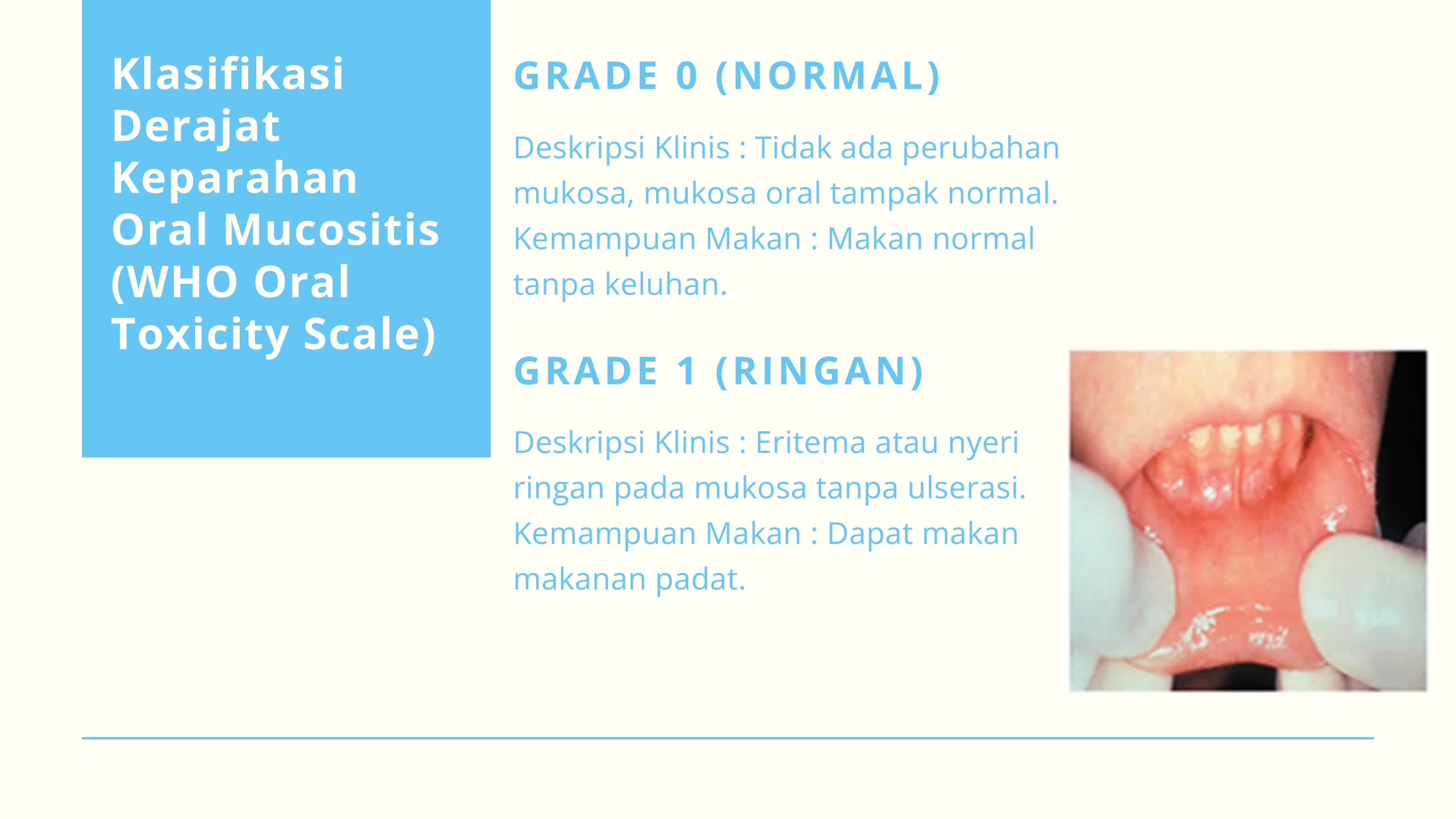 Gambar 2 untuk Klasifikasi Oral Mucositis