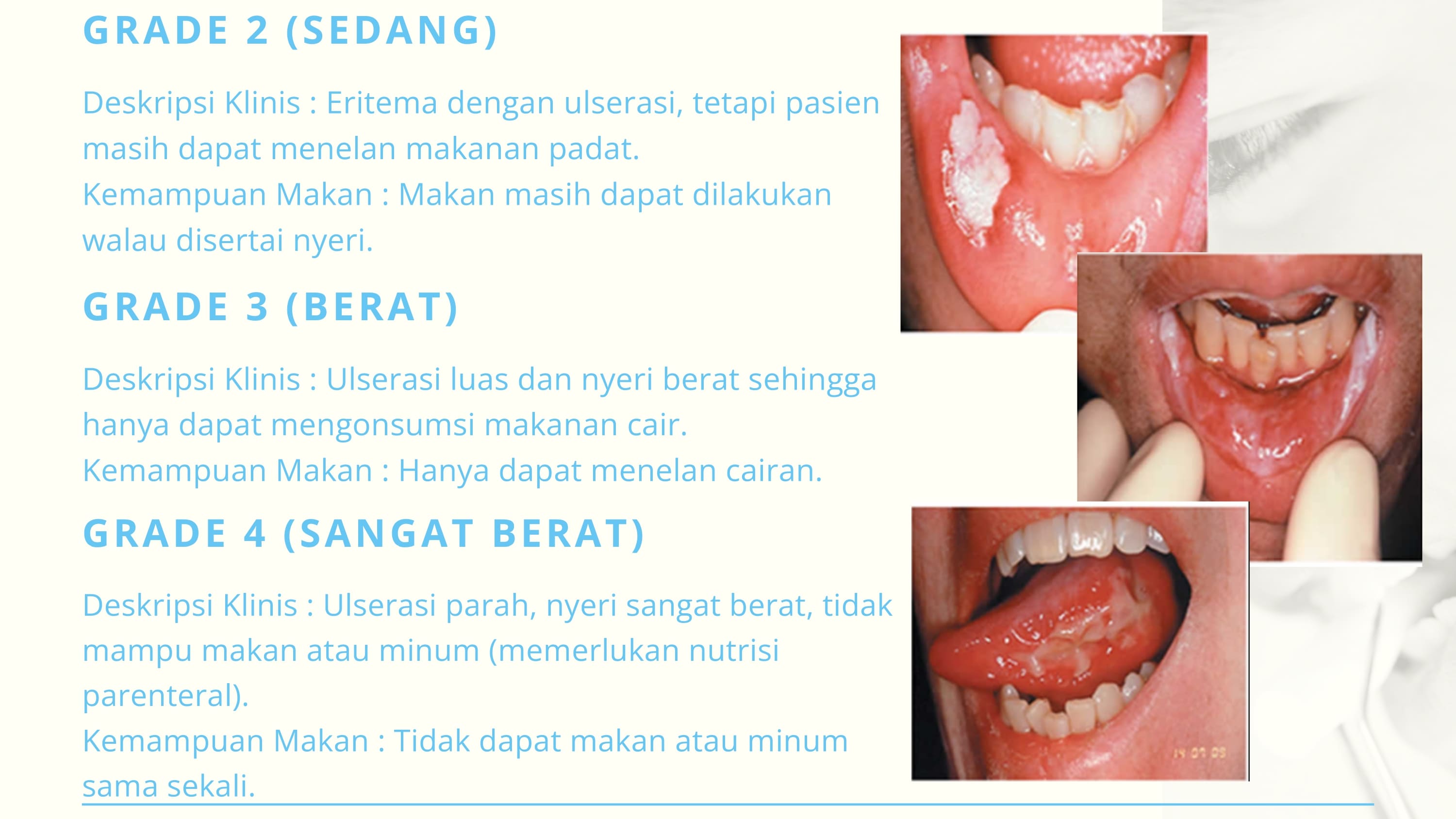 Gambar 3 untuk Klasifikasi Oral Mucositis