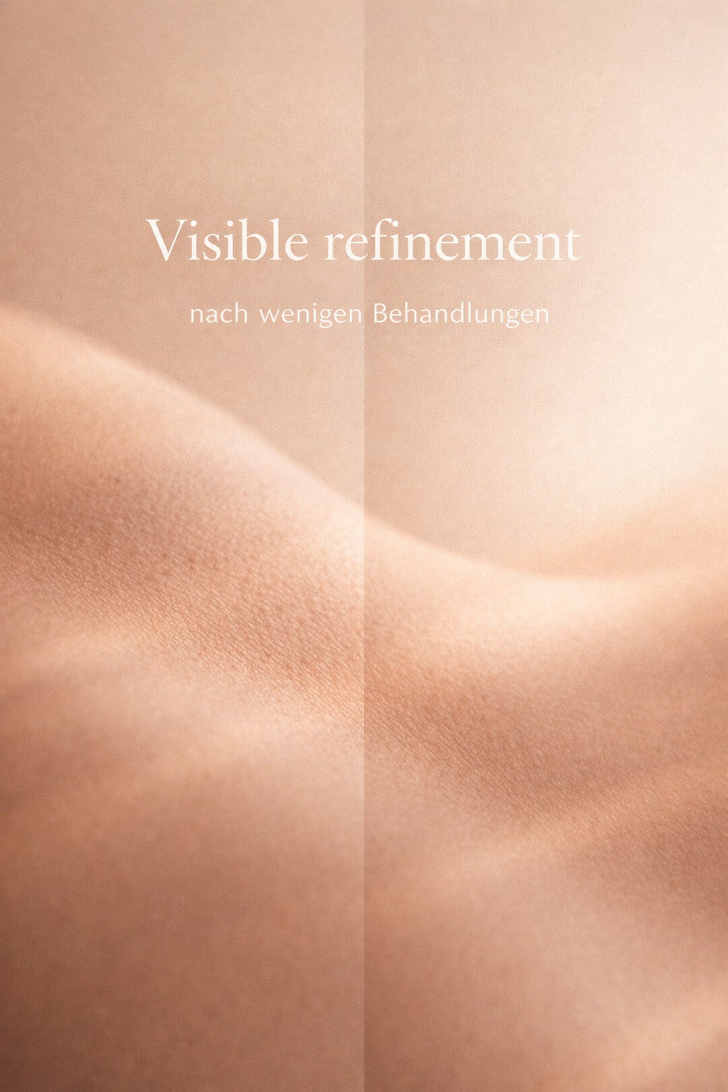 Kryolipolyse bei Na Beauty Spa Berlin
