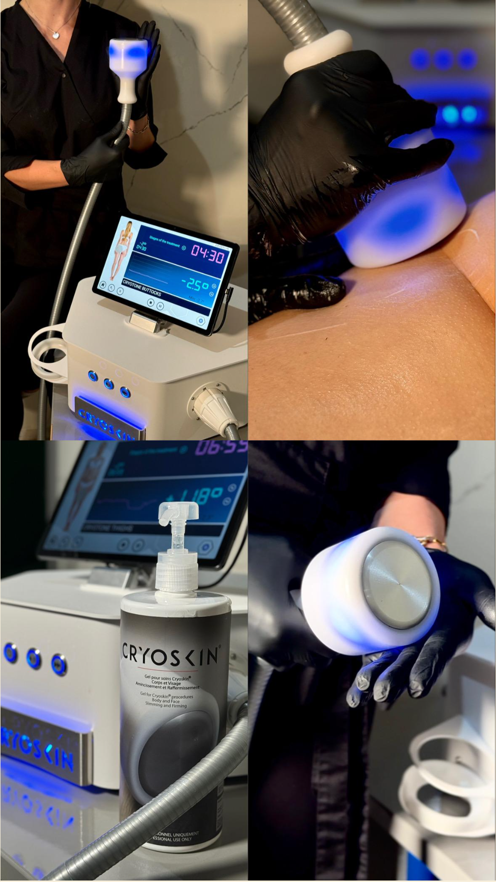 Esthetica Result — Laser