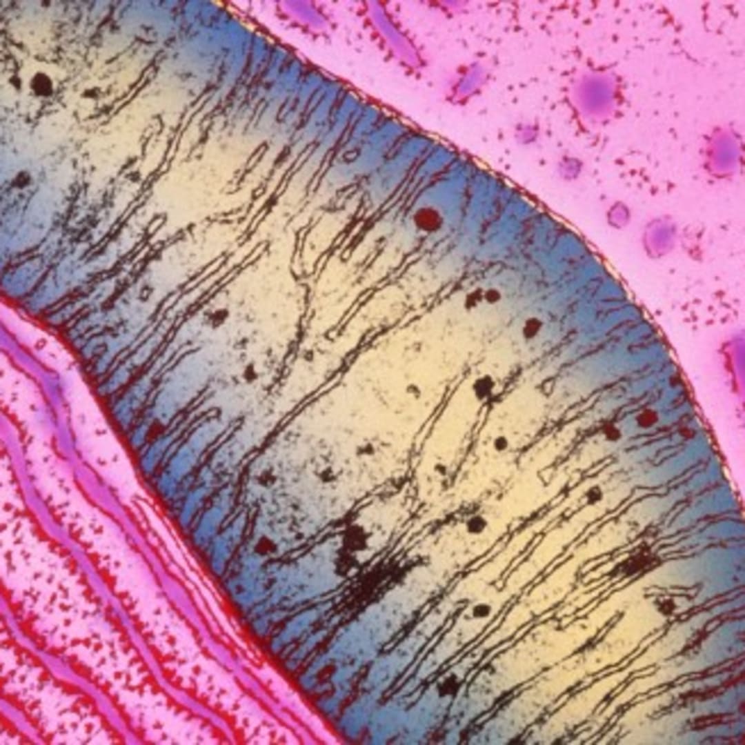 Mitokondria Bisa Berpindah Antar Sel, Sel Kanker Gunakan Cara Ini untuk Kalahkan Sel Imun