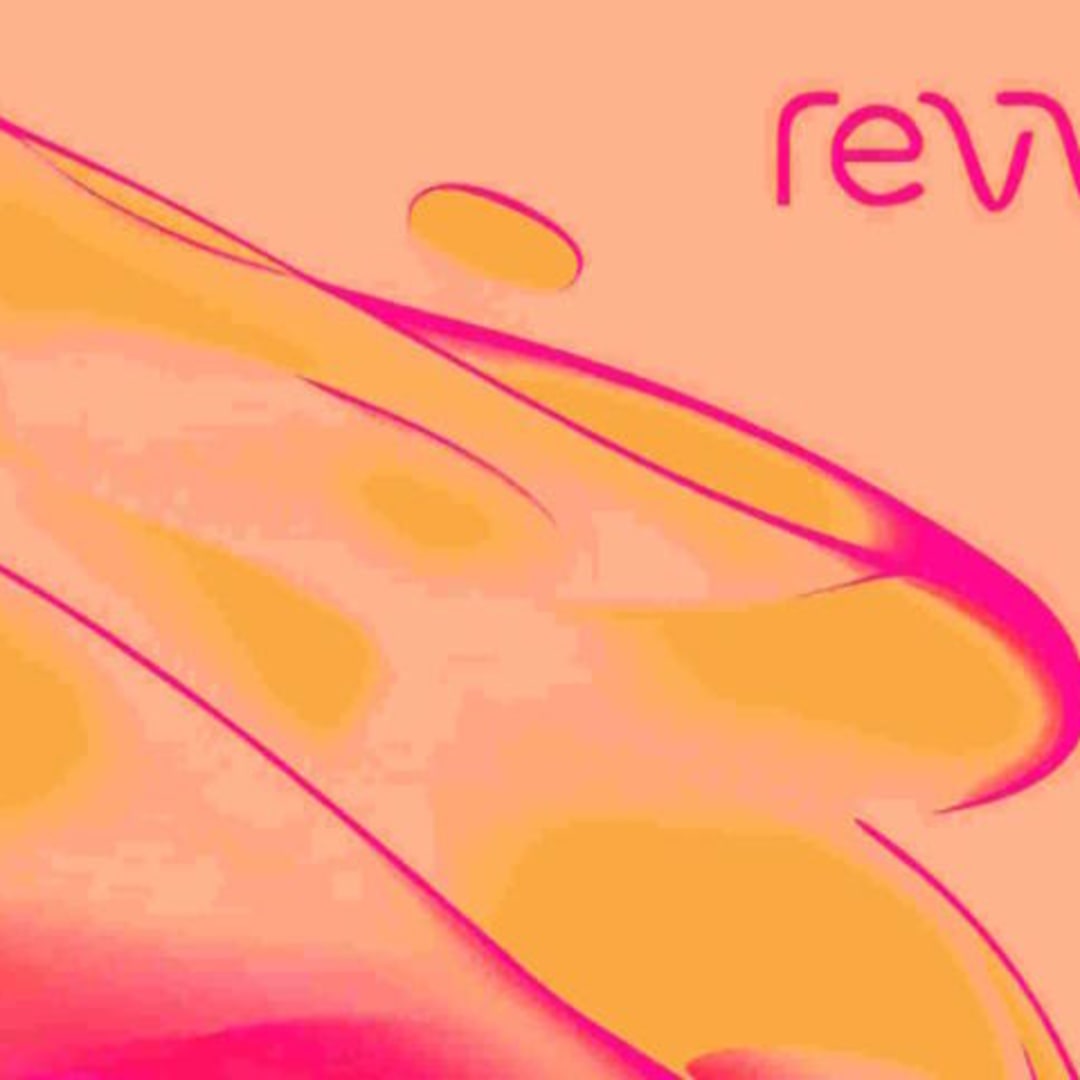 Apakah Sekarang Waktu Tepat Membeli Saham Revvity Setelah Laporan Q4 2024?