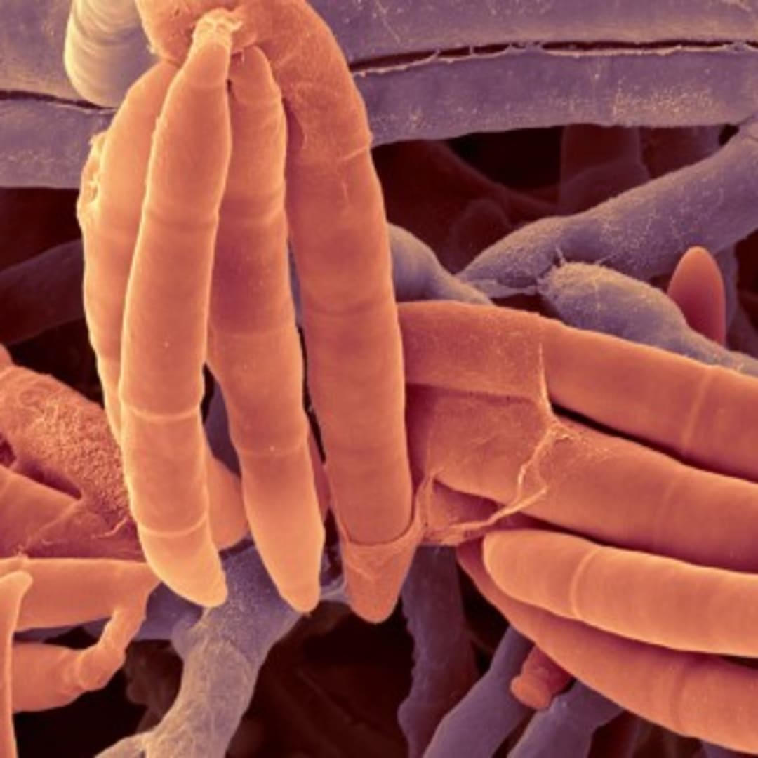 Jamur Usus Fusarium foetens Turunkan Gejala Penyakit Hati Berlemak