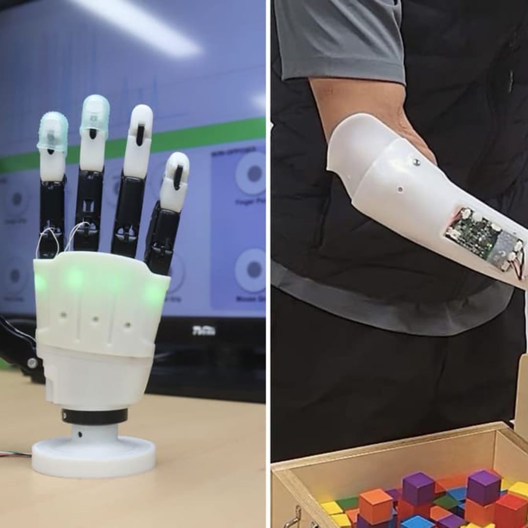Tangan Prostetik Robotik Ringan dengan Kontrol Presisi dan Adaptasi Bentuk