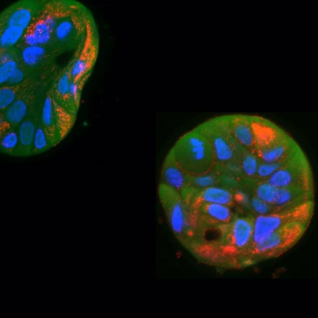 Peneliti Belanda Temukan Cara Baru Mengobati Penyakit Mitokondria dengan Precision Gene Editing