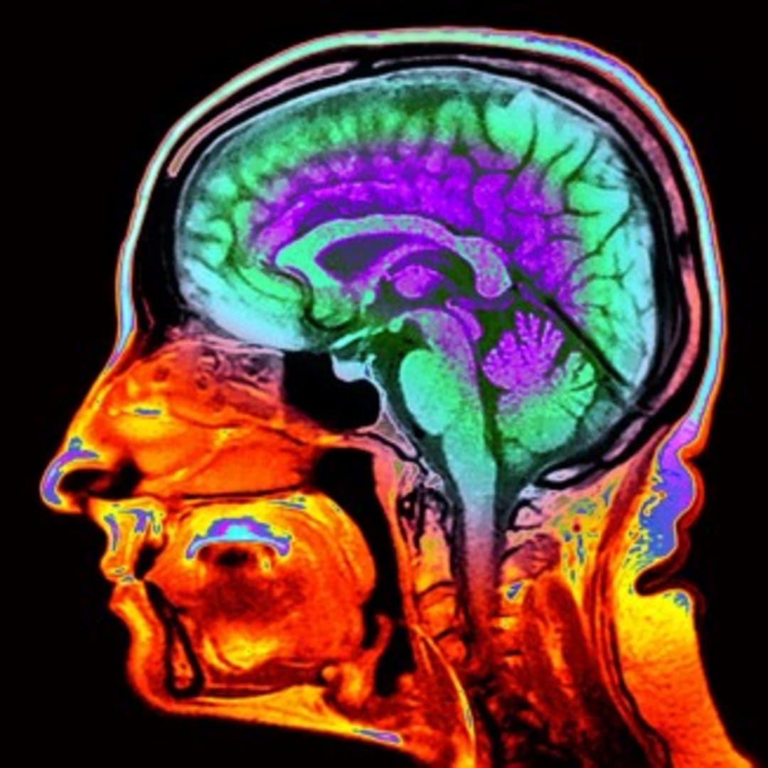 Mempercepat Deteksi Penuaan Otak dengan Citra MRI untuk Prediksi Risiko Kognitif