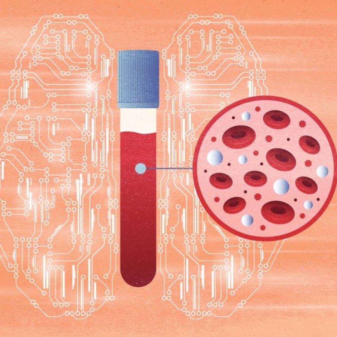 Metode AI 'Fragle' Mempermudah dan Mempercepat Pemantauan Kanker Lewat Darah
