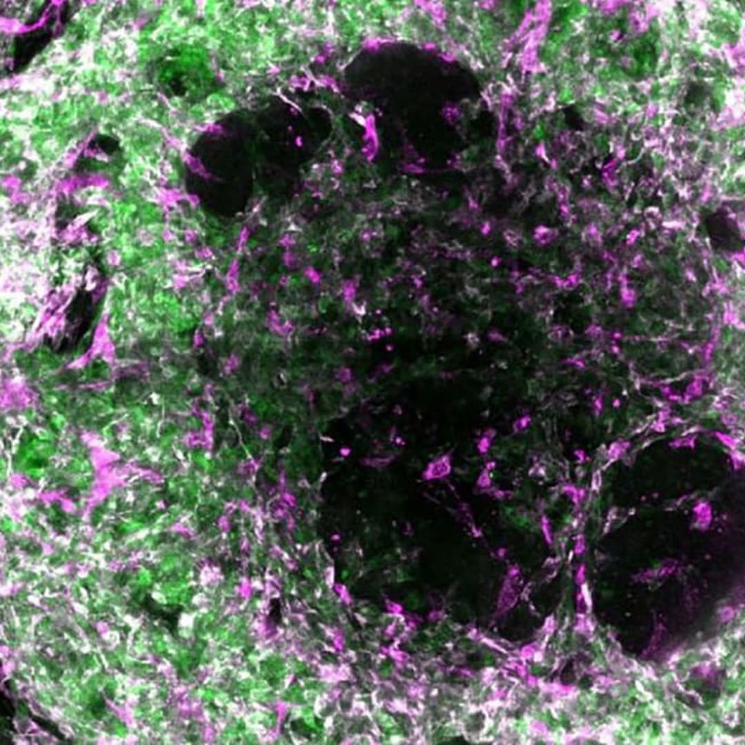 Peneliti Ciptakan Organoid dengan Pembuluh Darah untuk Organ Mini Lebih Sempurna