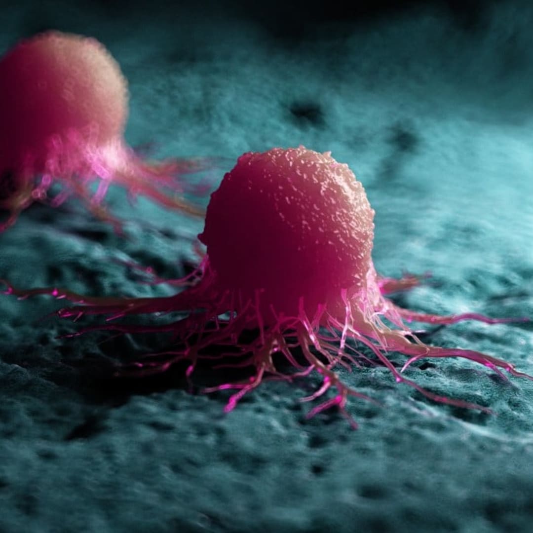 Vaksin Nanopartikel Baru Menjanjikan Perawatan Kanker Personal yang Lebih Efektif