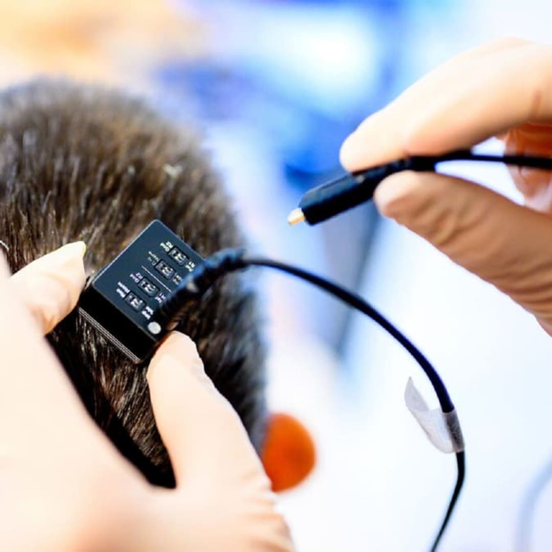 Teknologi Otak-Komputer Mengembalikan Suara Penderita Lumpuh Total Dengan AI Real-Time