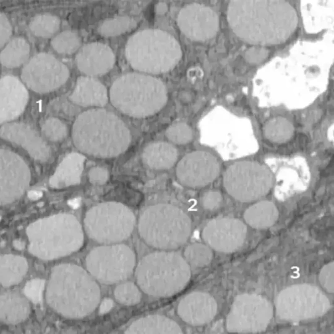 Sel ‘Muntah’ Untuk Cepat Sembuhkan Luka, Tapi Berisiko Kanker