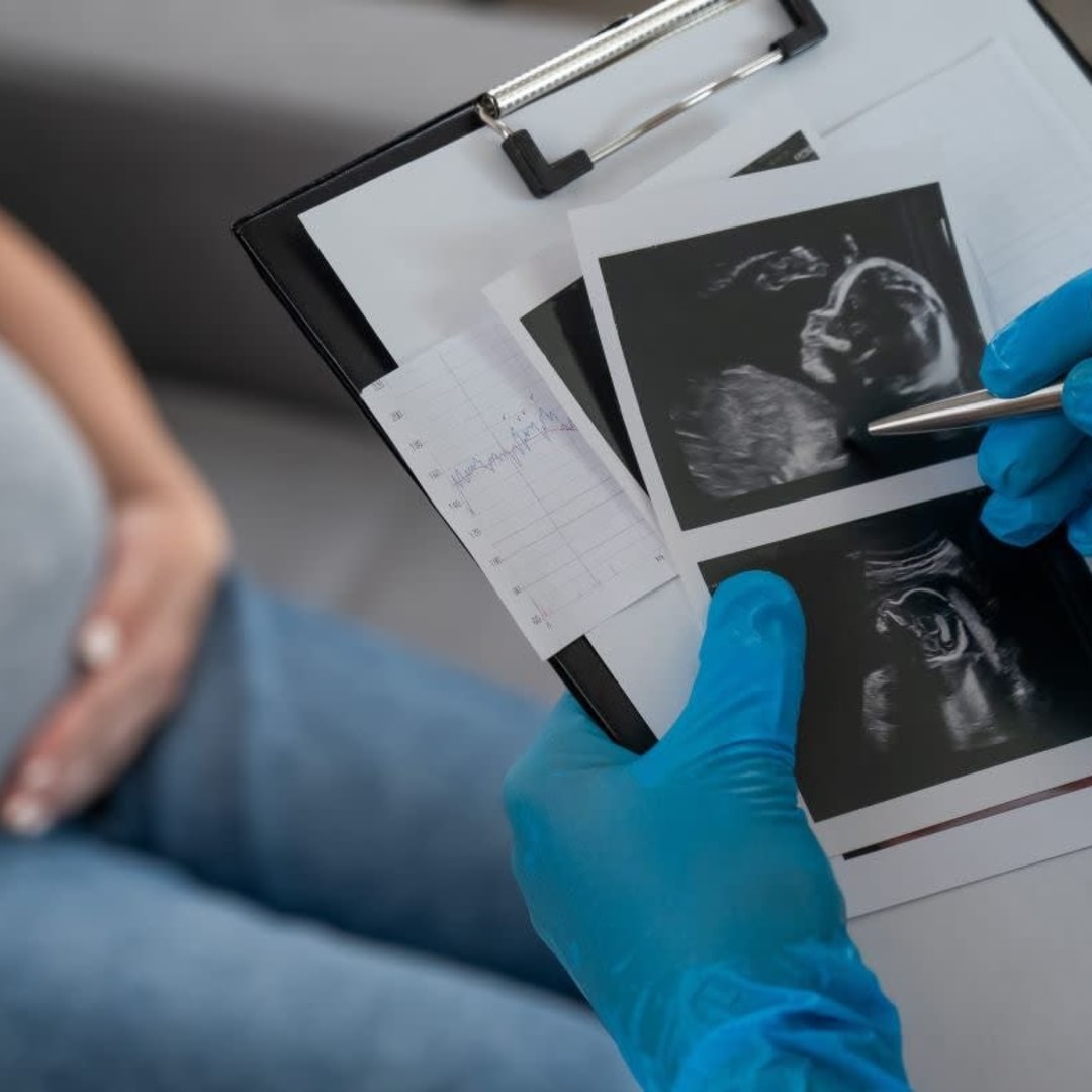 Lōvu Health Kumpulkan Dana Rp 131.56 miliar ($8 Juta)  untuk Solusi AI Perawatan Ibu Hamil