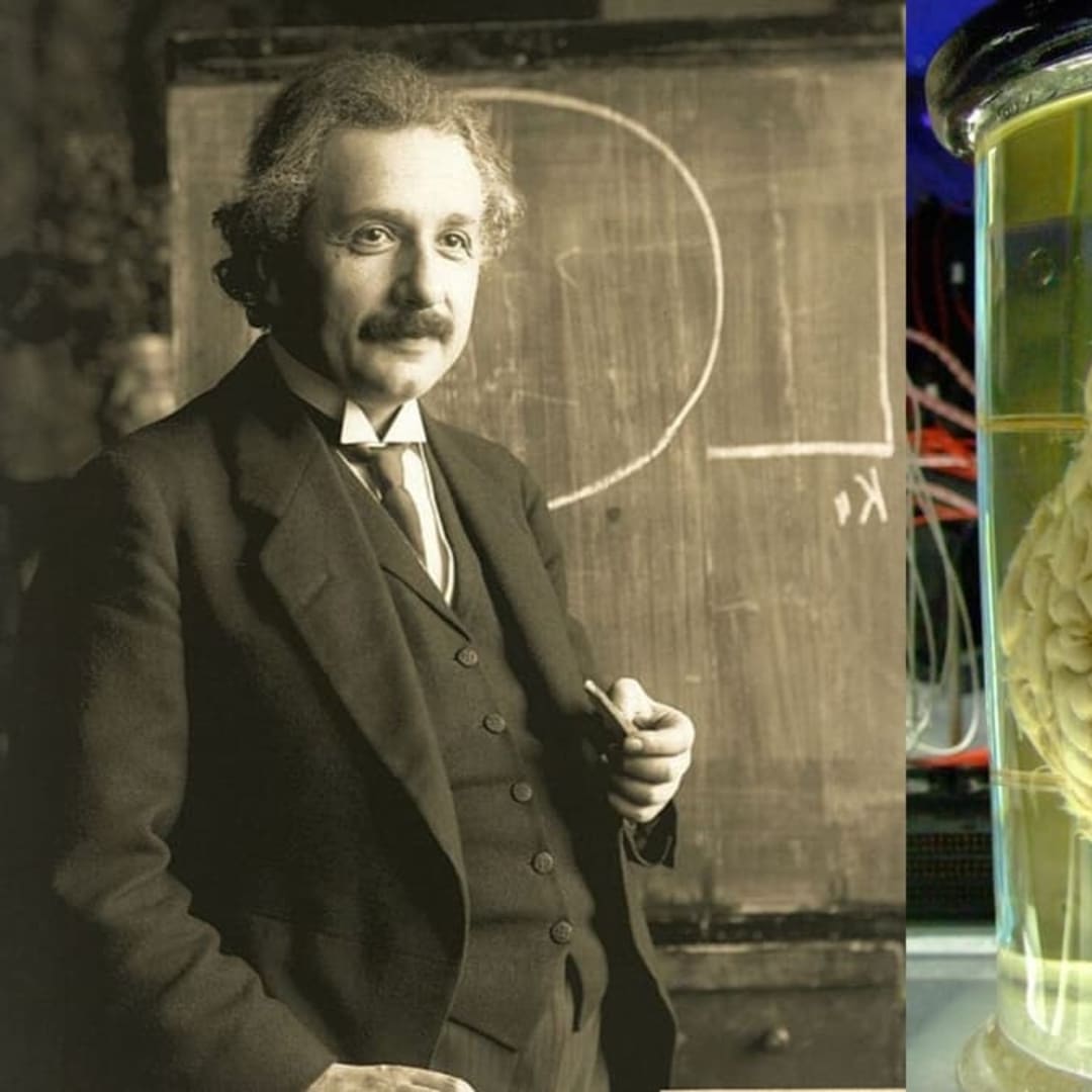 Teknologi Baru Buka Rahasia Jaringan Lama: Menelusuri Jejak Gen Einstein dan Kanker - image 1