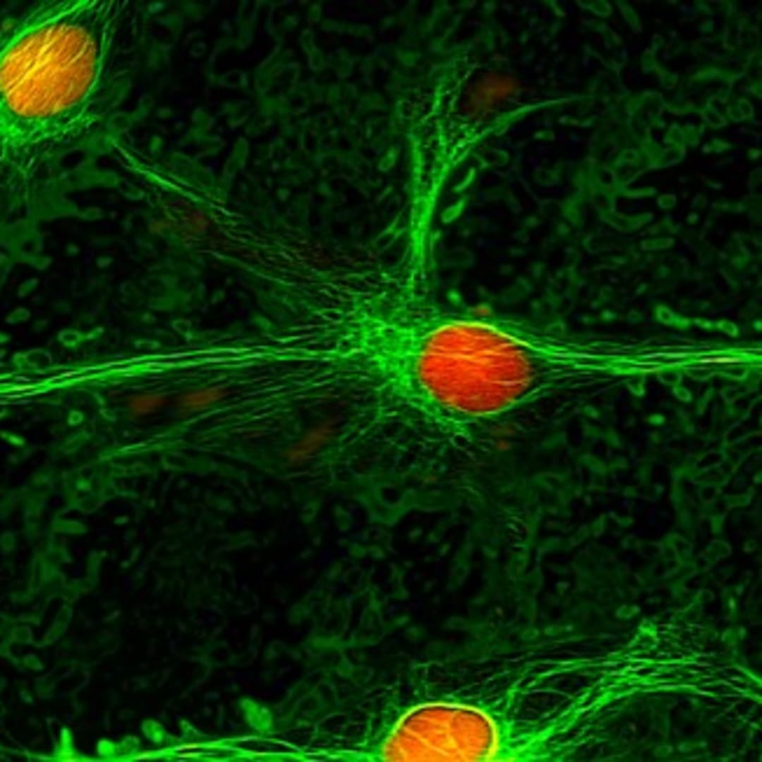 Penemuan Neuron Khusus Bisa Bantu Redakan Nyeri Kronis Secara Alami