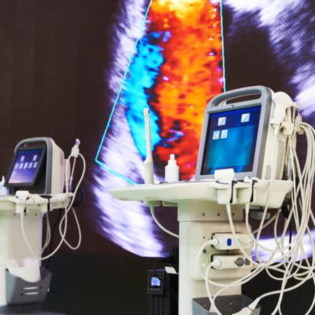 GE HealthCare dan Peluncuran Carestation 850: Peluang Besar di Tengah Tantangan Saham