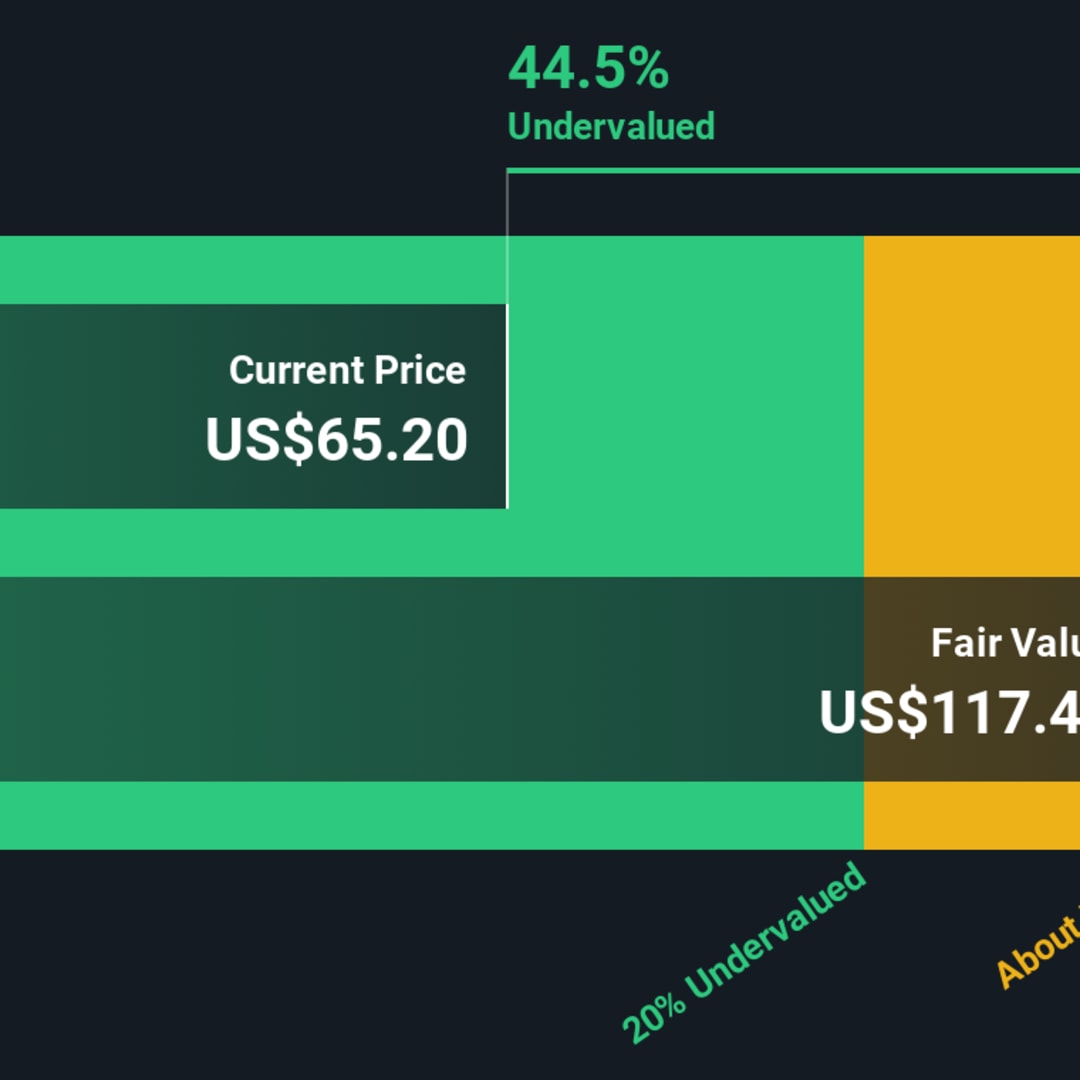 Apakah Saat yang Tepat untuk Investasi Saham DexCom? Analisis Mendalam Valuasi Terbaru