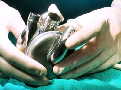 Australia Cetak Sejarah dengan Jantung Buatan Magnetik BiVACOR