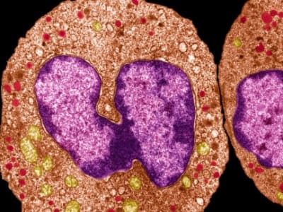 Neutrofil Perlindungi Luka dengan Membentuk Cincin Pelindung Kental