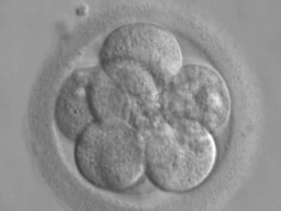 Kamera Kuantum Canggih Dukungan Baru untuk Kesuksesan Fertilisasi In Vitro