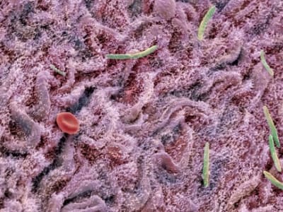 Diet Sehat Lebih Efektif Memulihkan Mikroba Usus Pasca Antibiotik
