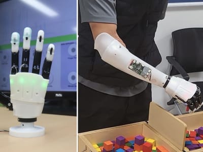 Tangan Prostetik Robotik Ringan dengan Kontrol Presisi dan Adaptasi Bentuk