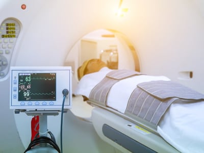 Model AI Alibaba Deteksi Kanker Lambung Dini Lewat CT Scan