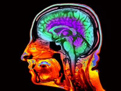 Mempercepat Deteksi Penuaan Otak dengan Citra MRI untuk Prediksi Risiko Kognitif