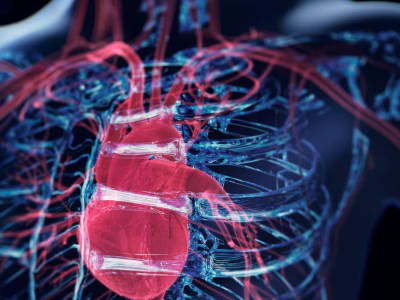 Inovasi 3D Printing dan Operasi Kompleks Selamatkan Pria dengan Aorta Membesar