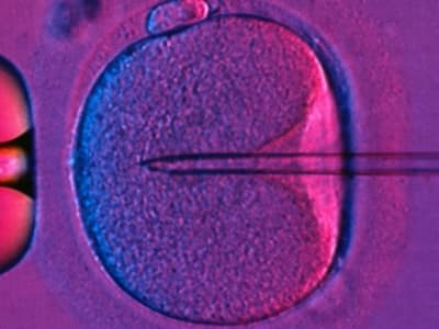 Teknik Tiga-DNA: Bayi Sehat Lahir dari Prosedur Mitochondrial Donation di Inggris